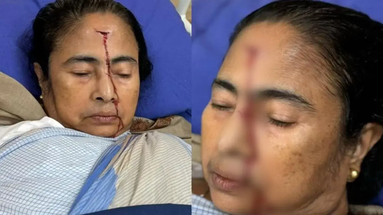 CM Mamata Banerjee got Injured while Walking, She was Admit in SSKM Hospital